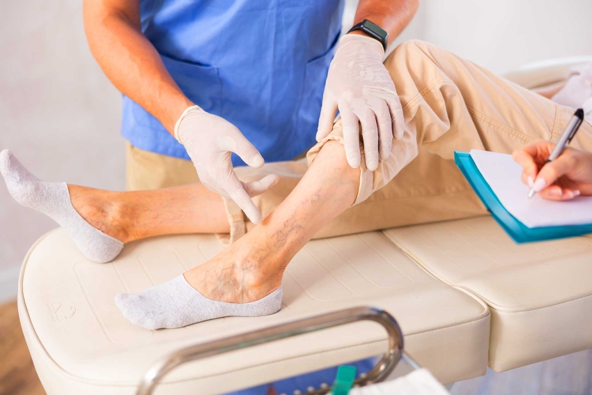 vein doctor vein specialist top vein doctors clinic River Vale, Bergen County, NJ