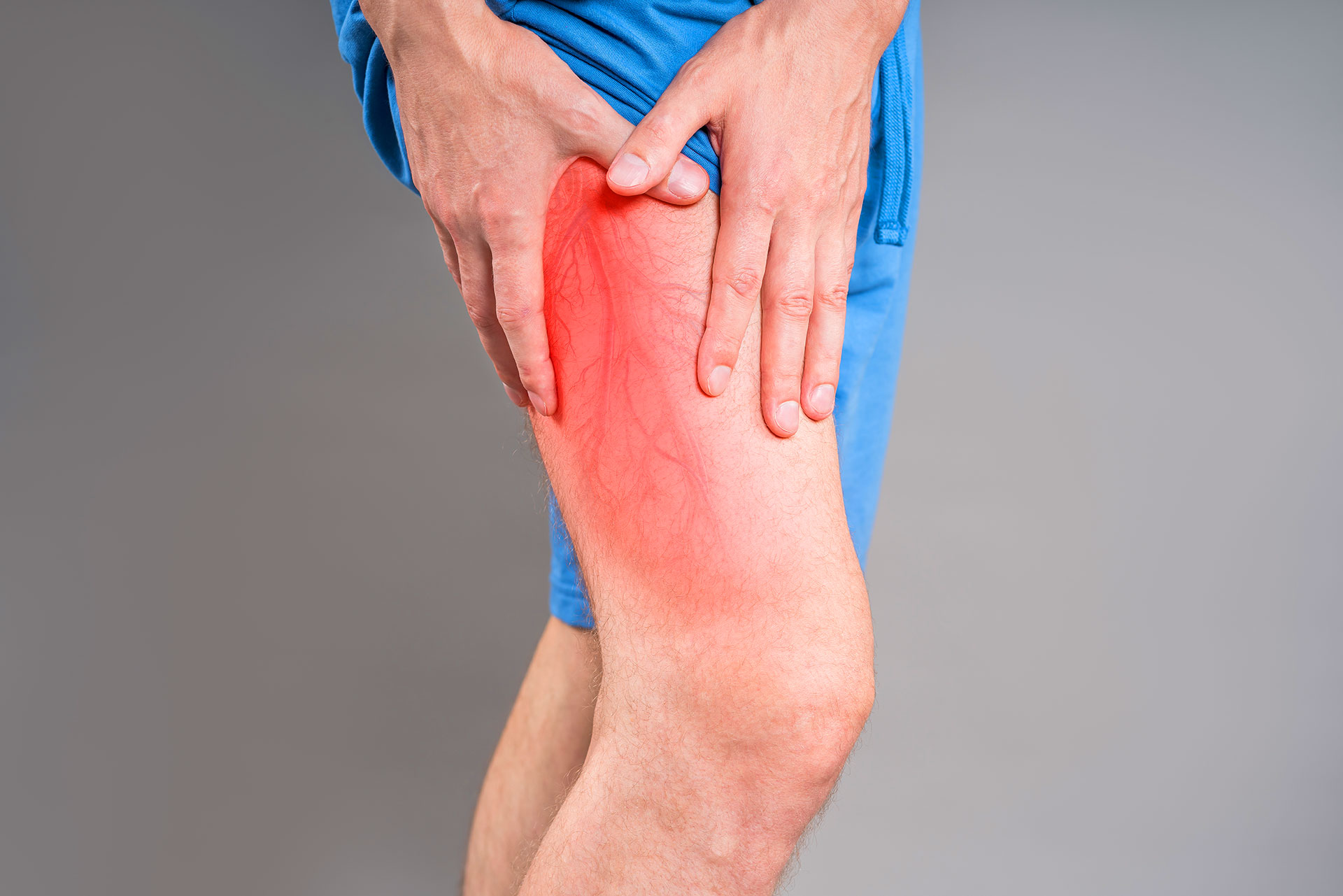 Recovery after radiofrequency ablation varicose veins treatment