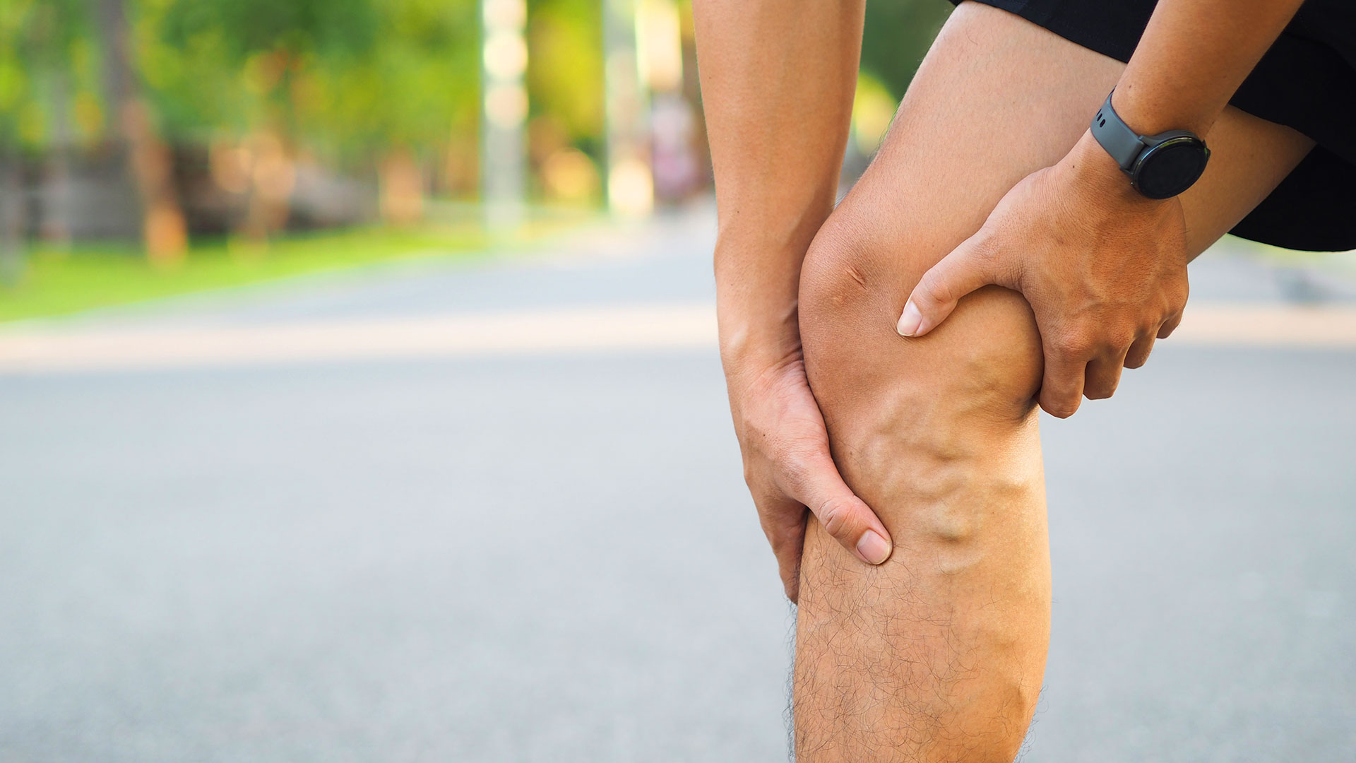 Skin discoloration near the ankle indicating advanced venous insufficiency before ulcer formation