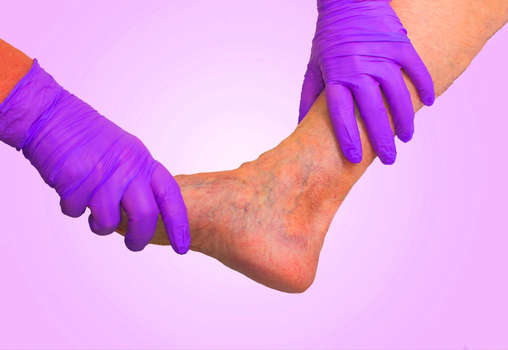 visible veins