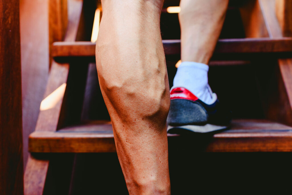  Close-up of muscular male leg with prominent veins climbing stairs