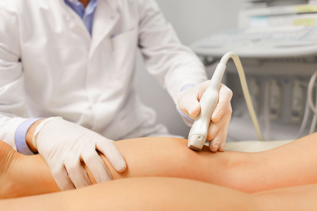 Physician with gloves using ultrasound probe to examine leg veins in clinical setting