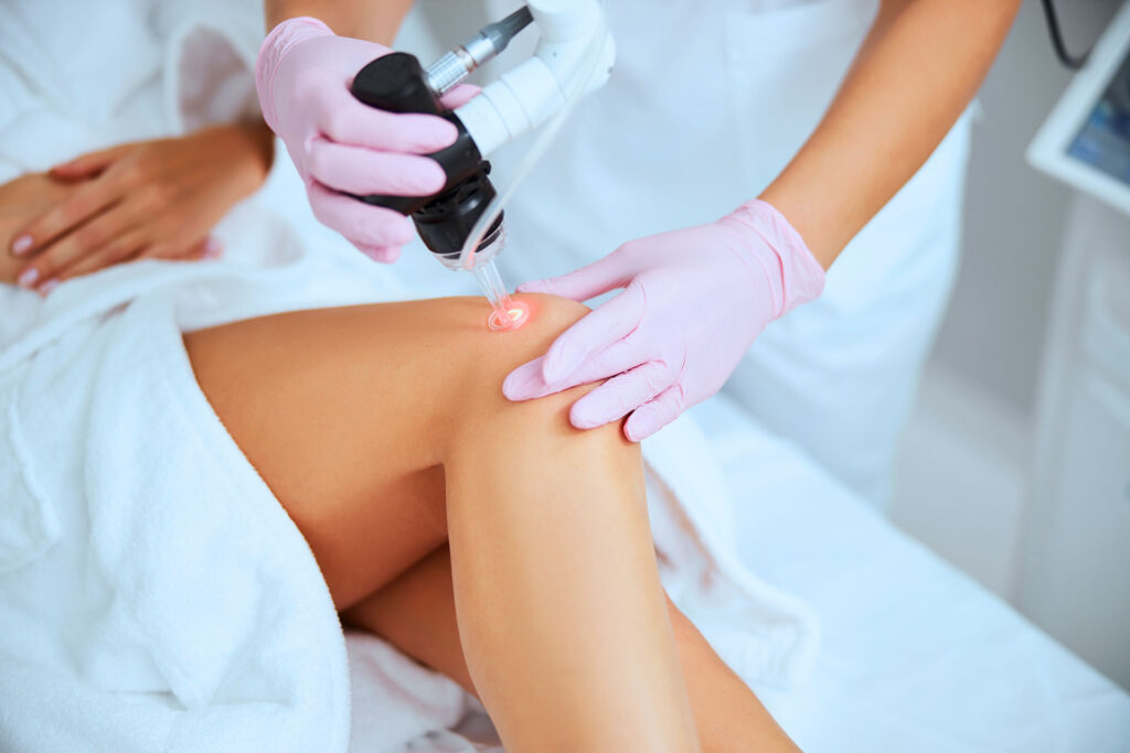 Dermatologist performing laser treatment on patient's knee for varicose vein removal
