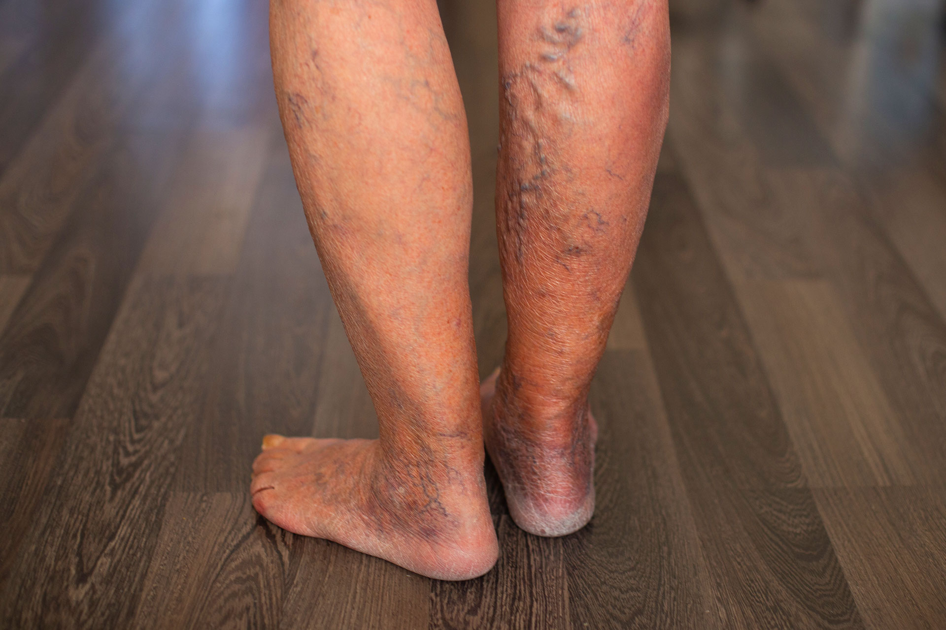 Doctor monitoring vitals while examining foot varicose veins
