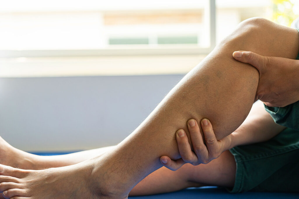 When Should You Actually See a Doctor for Leg Cramps?