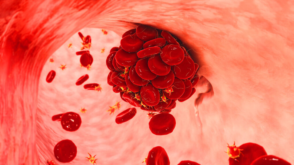 Close-up medical 3D animation showing red blood cells forming a clot inside a blood vessel.