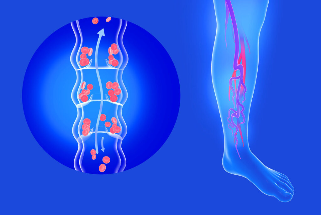 Medical 3D illustration demonstrating healthy blood flow and vein valve function in the lower leg.
