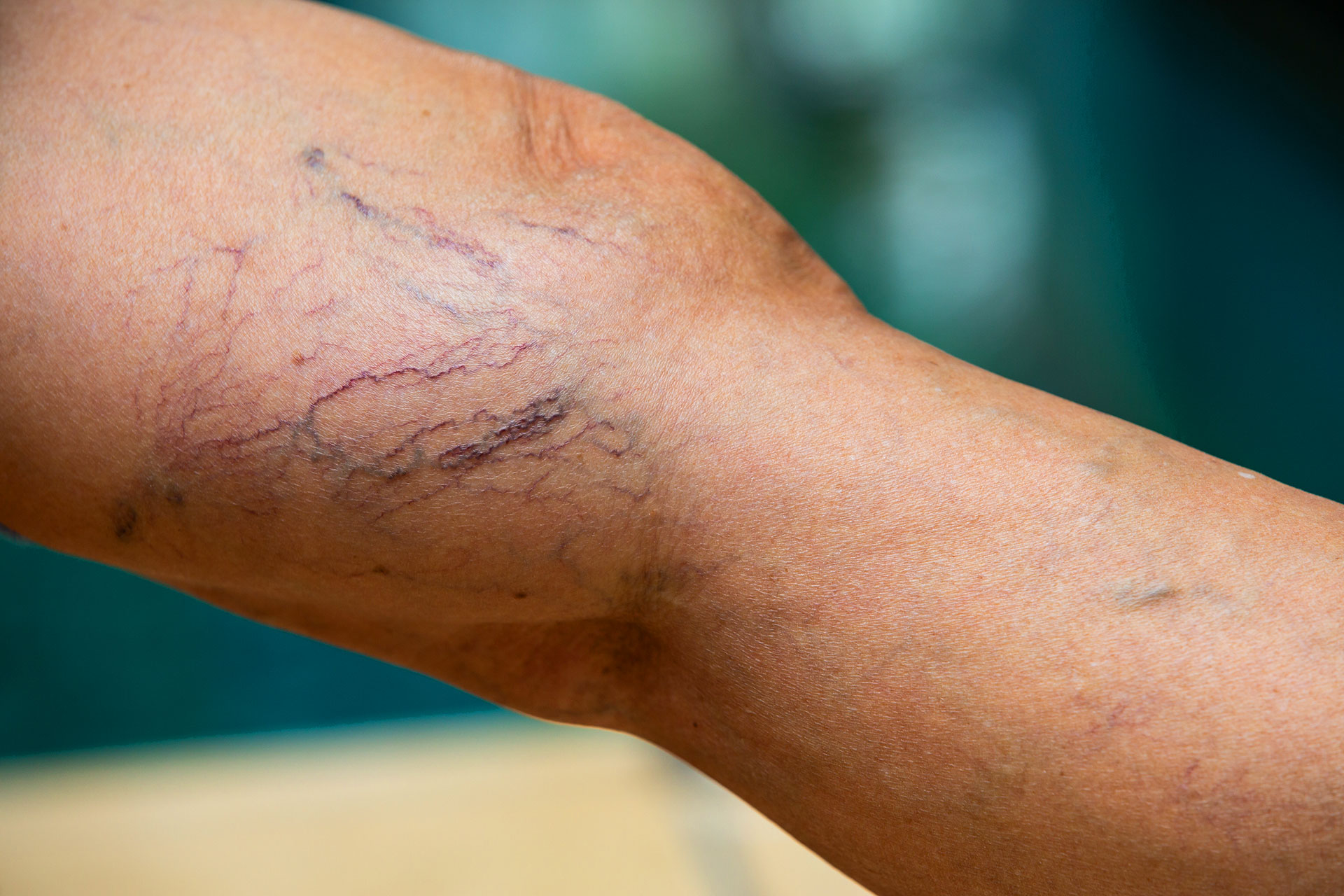 Poor Blood Circulation in Feet: Causes and How to Fix It