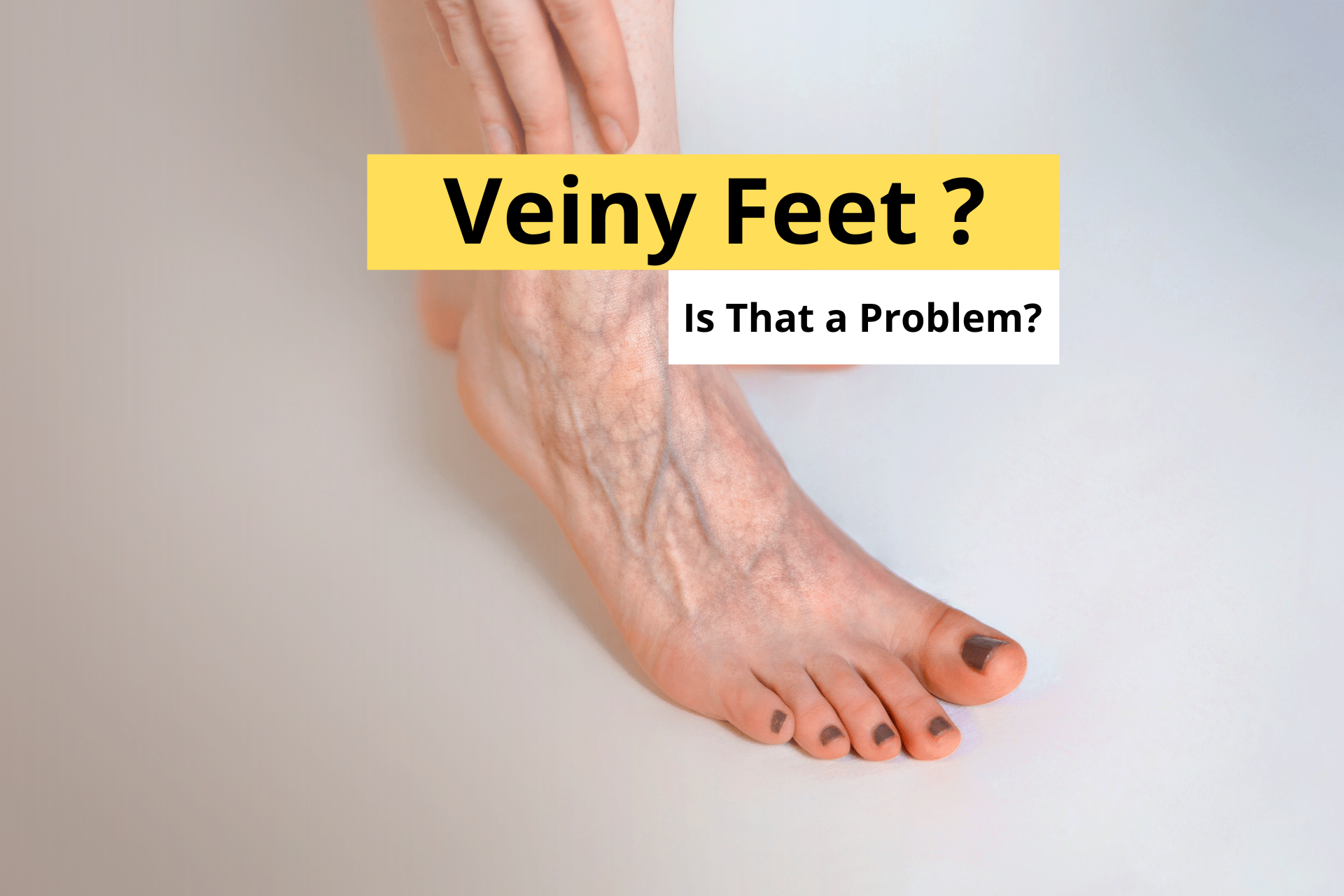 My Feet Are Veiny, Is That a Problem?