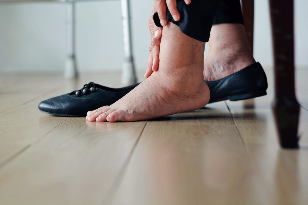 Elderly person sitting indoors with swollen ankles, illustrating circulation topics explored when asking is blood blue.