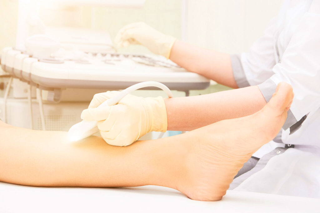 A medical professional performing an ultrasound scan on a patient's lower leg to evaluate circulation issues related to spider veins.