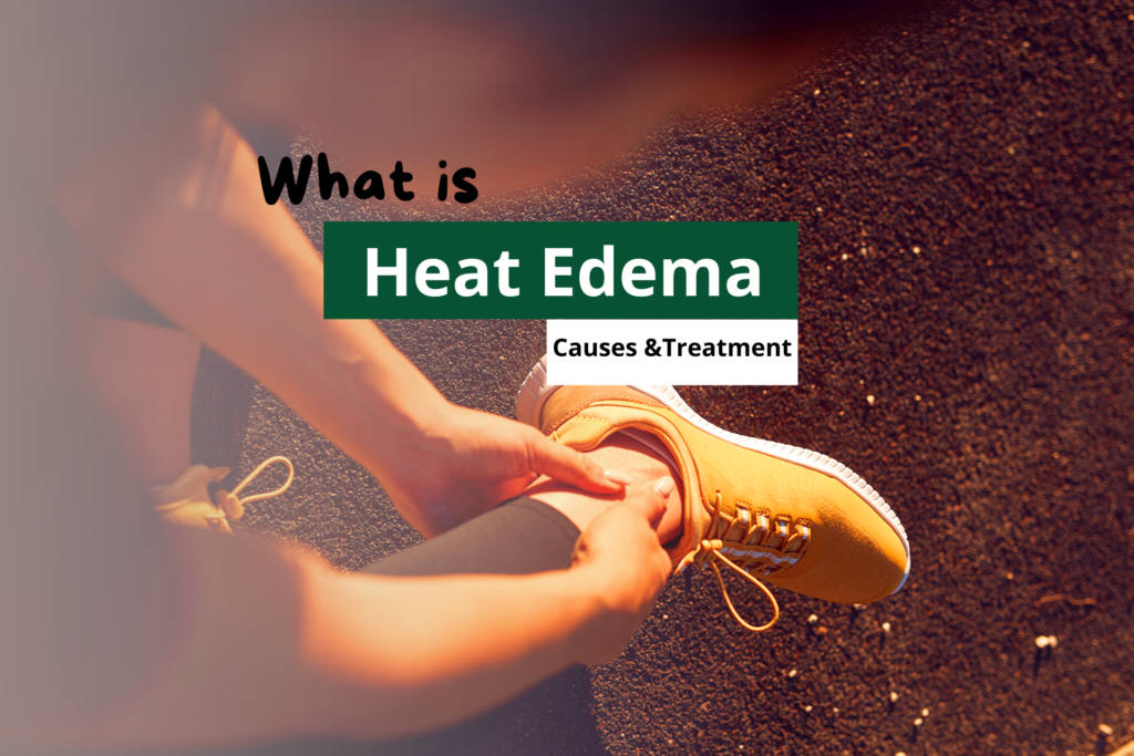 Top-down view of an runner holding a swollen ankle affected by heat edema on an outdoor track.