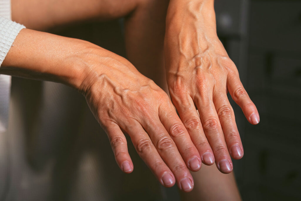 Close-up shot of hands facing downward, highlighting visible hand veins across the skin.