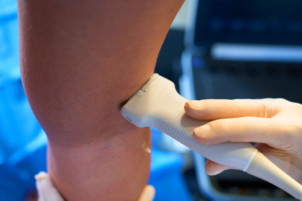 Medical professional performing a duplex ultrasound scan on a patient's leg to evaluate vein health before discussing whether ice reduce varicose vein pain.