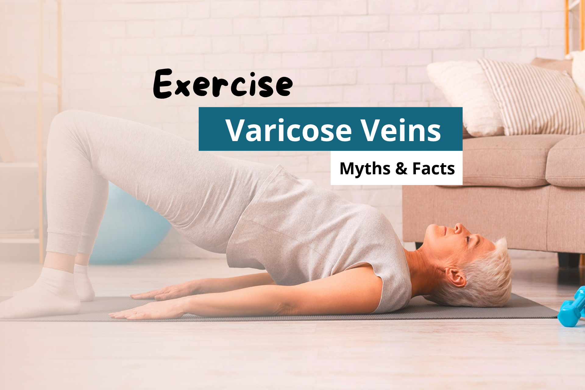 Can You Exercise With Varicose Veins? Myths and Facts