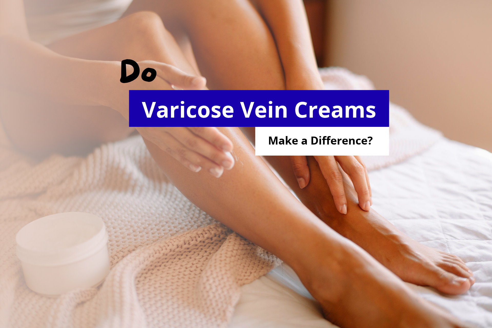 Do Varicose Vein Creams Really Make a Difference?